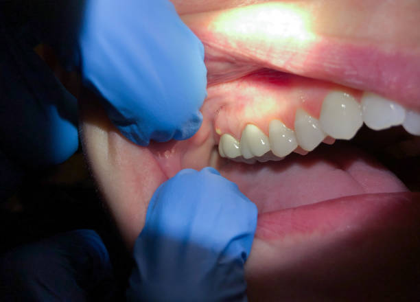 Best Emergency Root Canal Therapy in North Edwards, CA